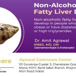 Non-Alcoholic Fatty Liver Disease (NAFLD) - Agrawal Gastro Center Indore