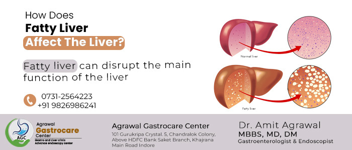 How Does Fatty Liver Affect The Liver?, Diagnosis - Dr. Amit Agrawal