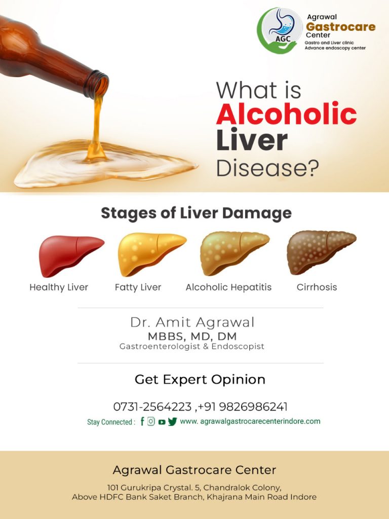 What is Alcoholic Liver Disease?, Symptoms, Causes, Treatment