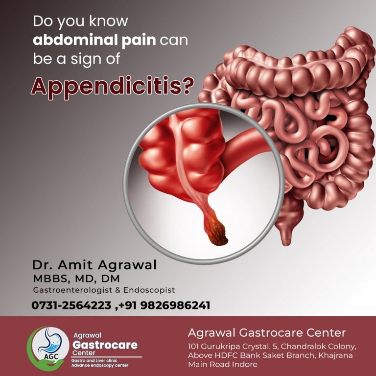 Appendicitis Causes Symptoms Treatment Agrawal Gastrocare Center