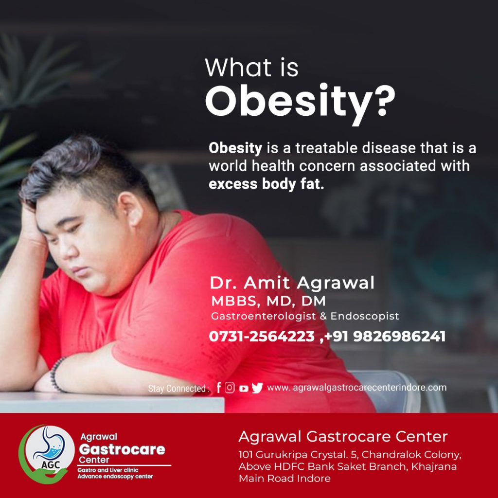What is Obesity?, Causes, Symptoms, Treatment