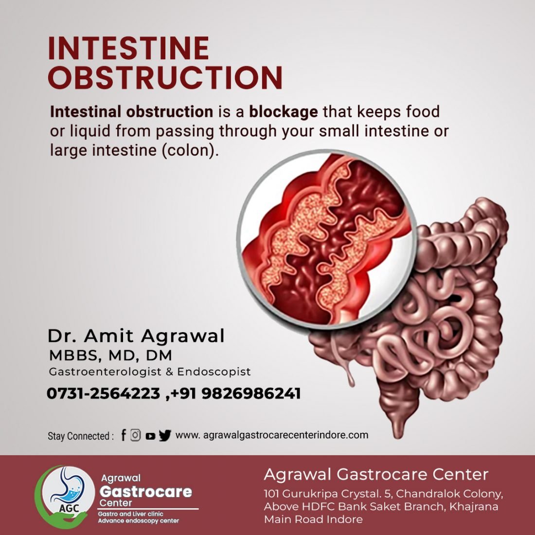 Intestine Obstruction, Causes, Symptoms, Treatment - Agrawal Gastrocare ...