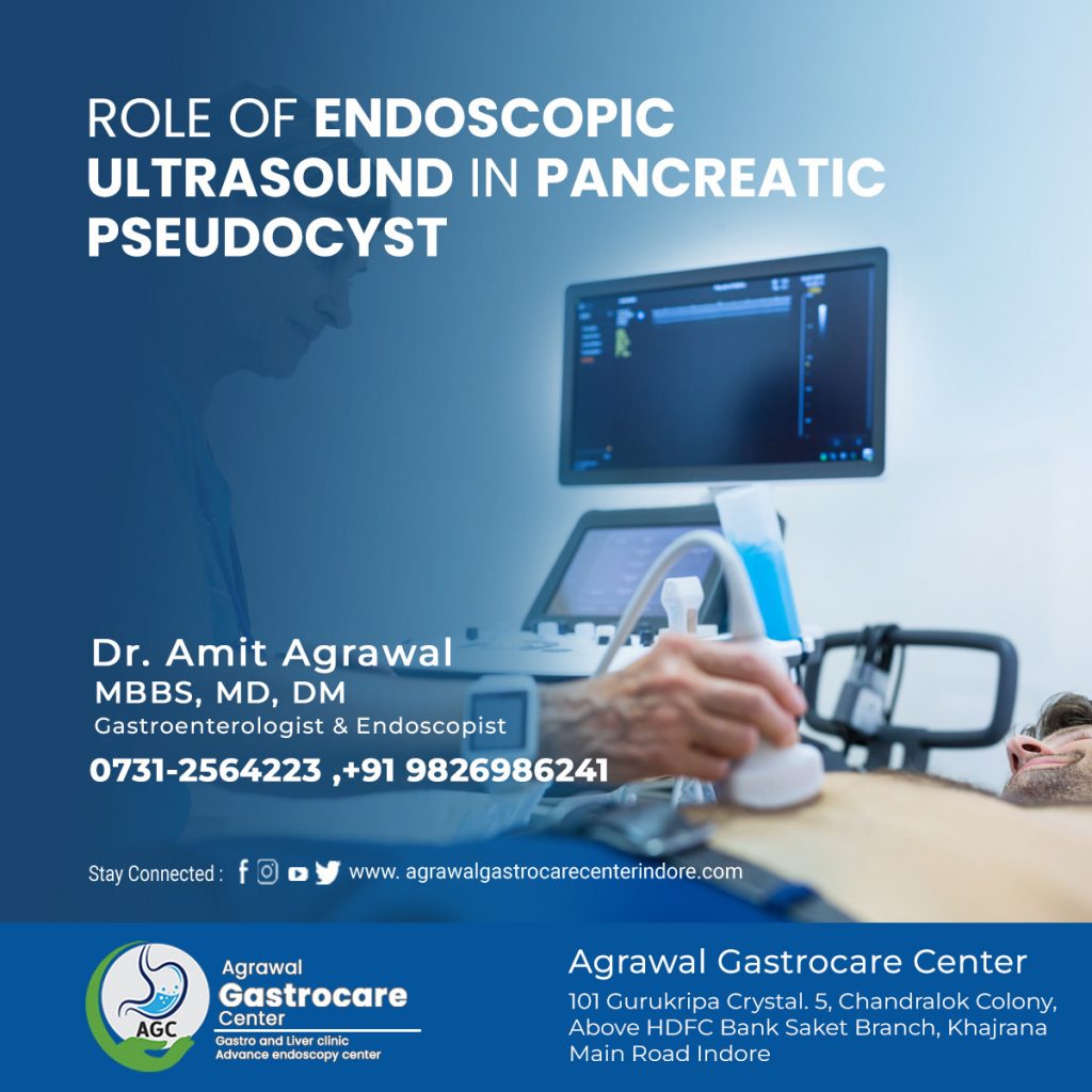 Role of Endoscopic Ultrasound in Pancreatic Pseudocyst - Agrawal Gastrocare Center Indore
