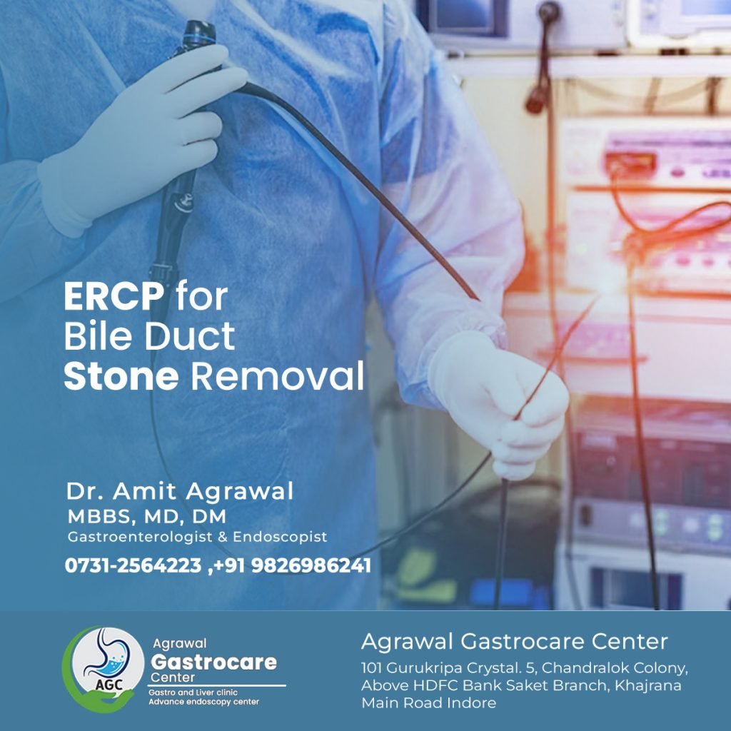 ERCP for Bile Duct Stone - Agrawal Gastrocare Center Indore