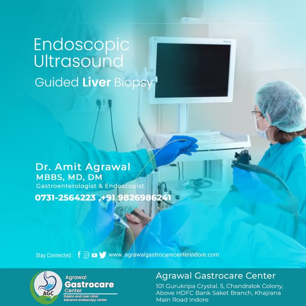 Endoscopic Ultrasound-Guided Liver Biopsy - Agrawal Gastrocare Center Indore