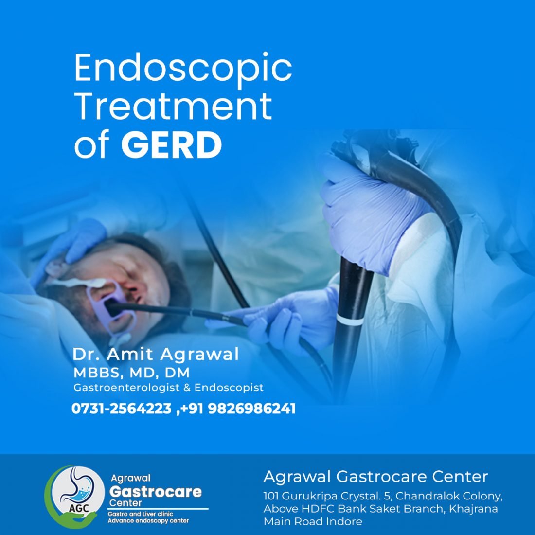 Endoscopic treatment of GERD (Gastroesophageal Reflux Disease)