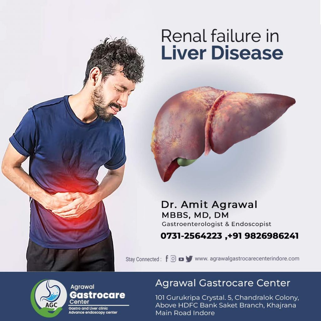 Renal Failure in Liver Disease, Symptoms, Causes, Diagnose, Treatment