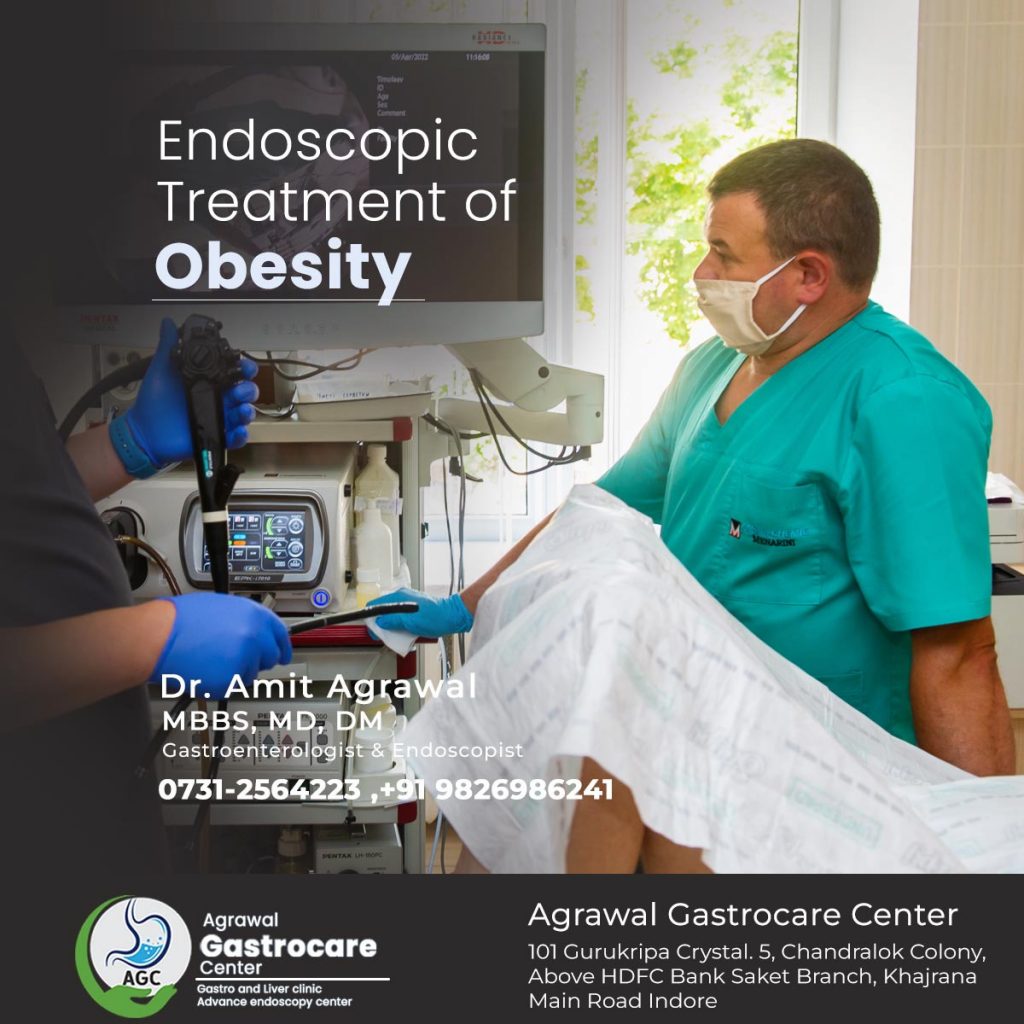 Endoscopic Treatment of Obesity - Agrawal Gastrocare Center Indore