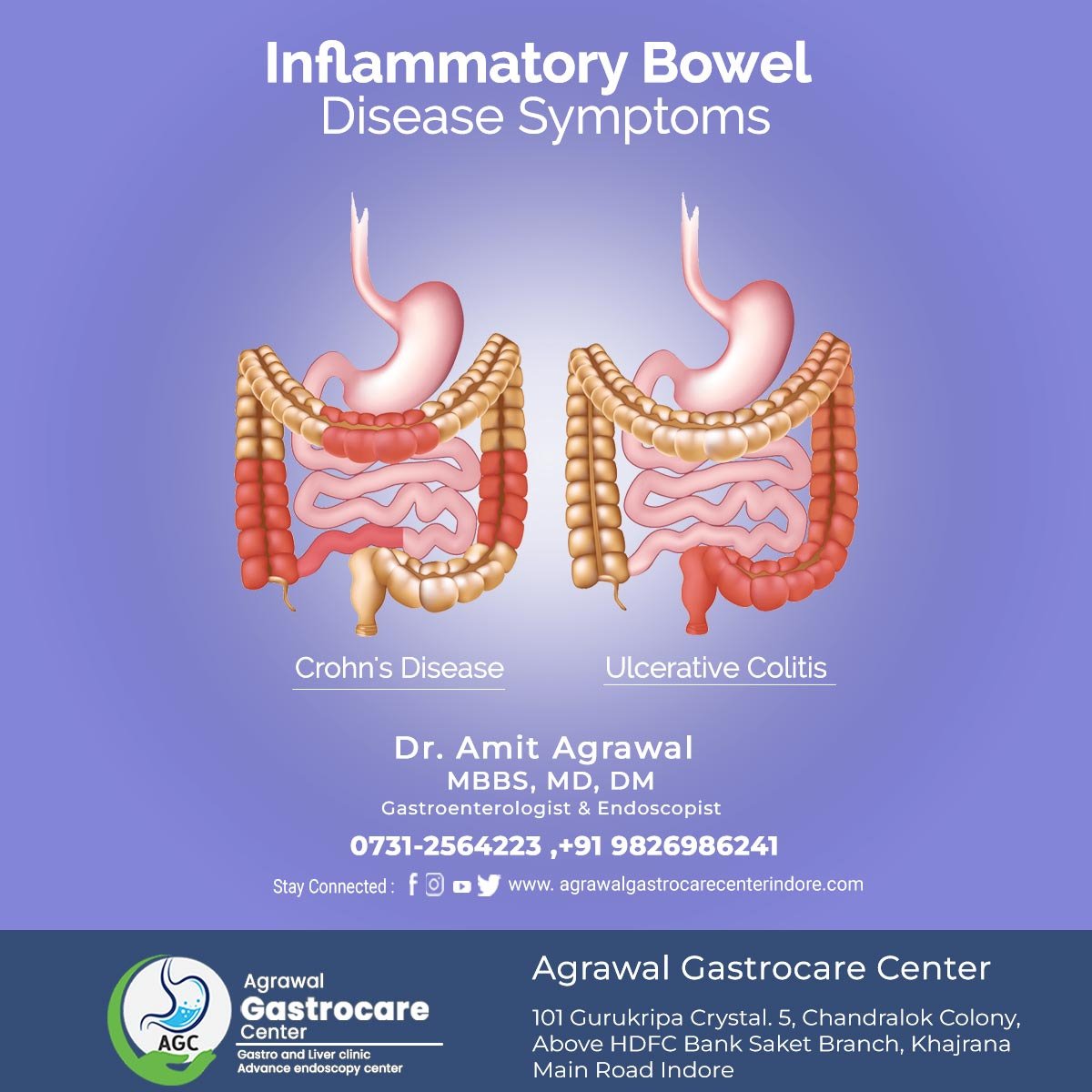 Inflammatory Bowel Disease Symptoms Cause Treatment Agrawal