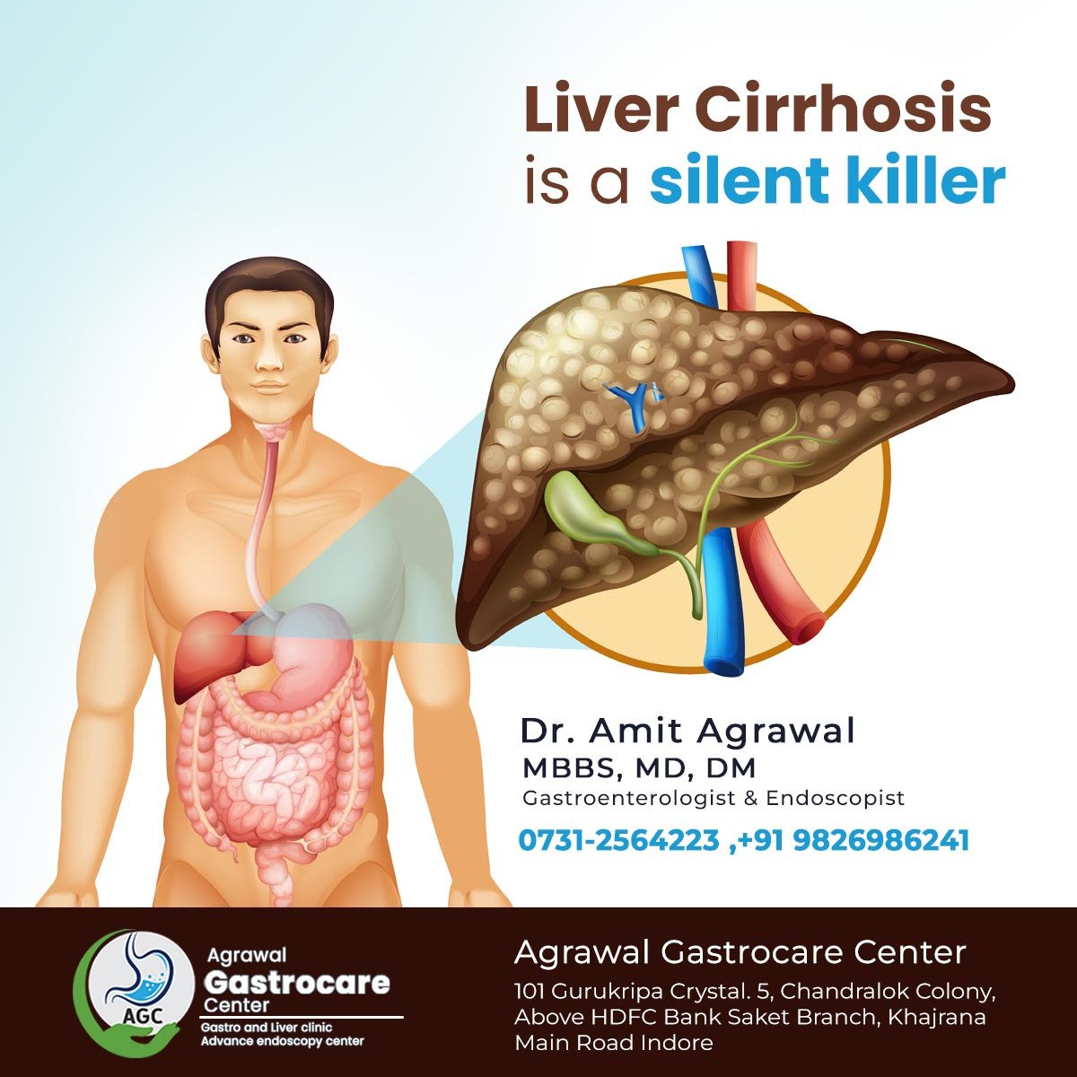 Liver Cirrhosis Is A Silent Killer Agrawal Gastrocare Center Indore