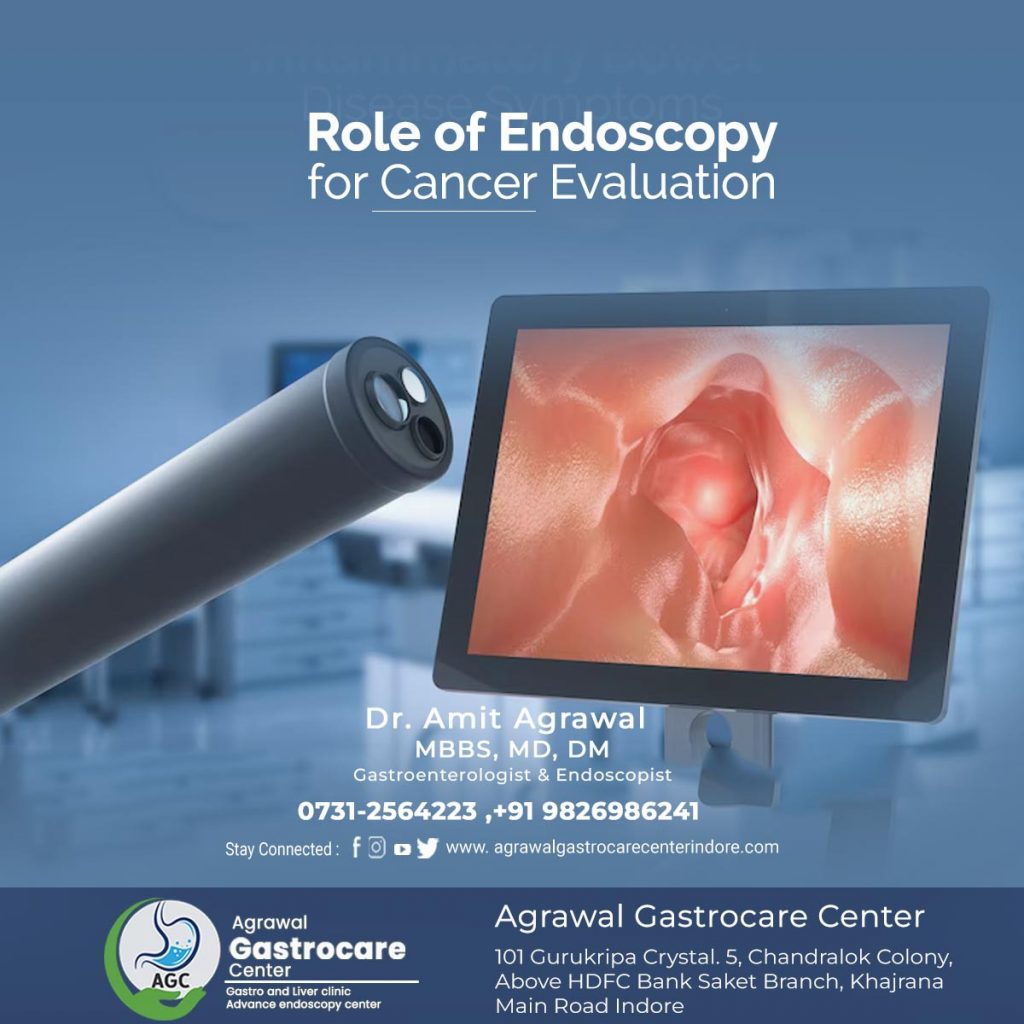 Role of Endoscopy for Cancer Evaluation - Agrawal Gastrocare Center Indore