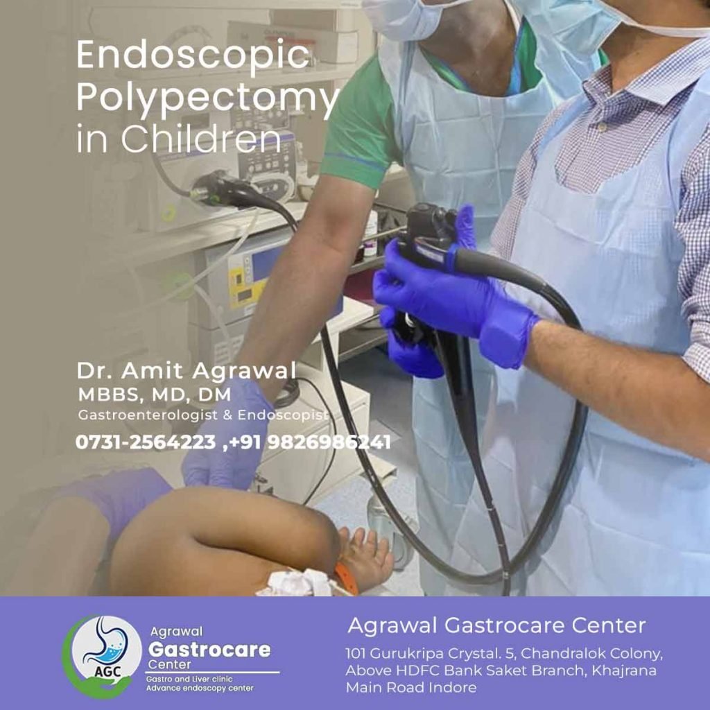 Endoscopic Polypectomy in Children - Agrawal Gastrocare Center Indore
