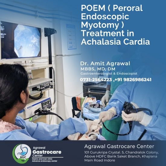 POEM (Peroral Endoscopic Myotomy) Treatment in Achalasia Cardia ...