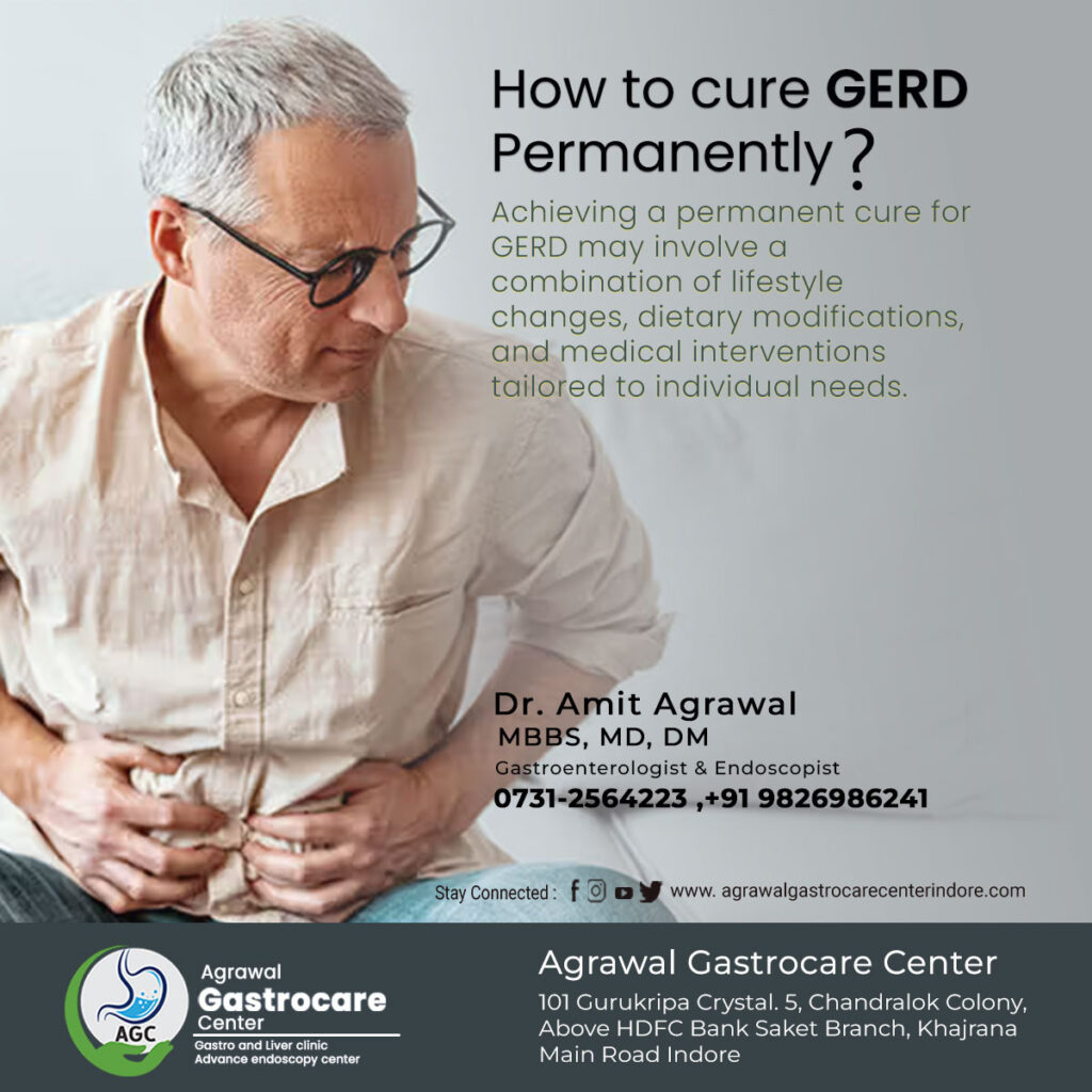 How to Cure GERD Permanently?