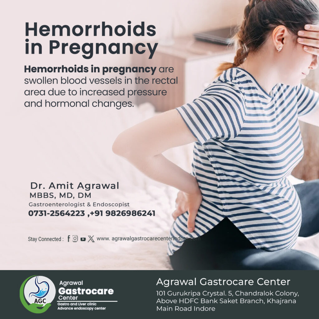 Hemorrhoids in Pregnancy, Symptoms, Causes, Treatment 