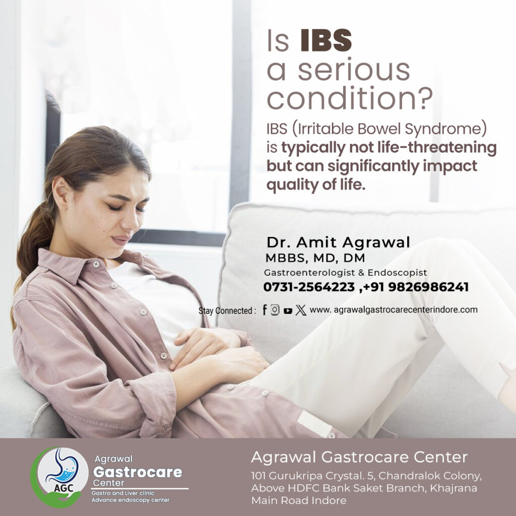 Is IBS (Irritable Bowel Syndrome) a Serious Condition?