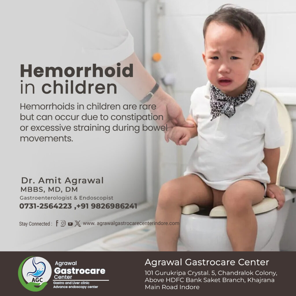 Hemorrhoid in children, Causes, Symptoms, Treatment & More