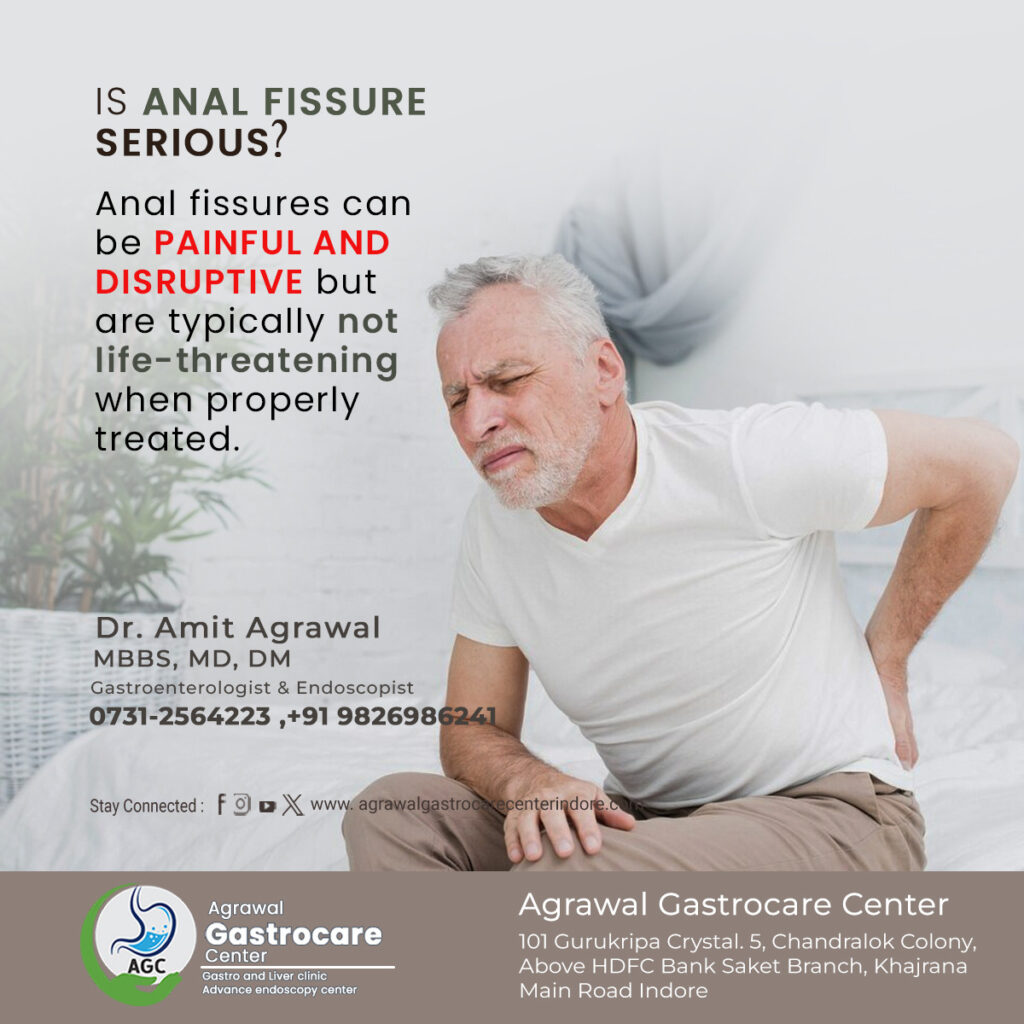 Is Anal Fissure Serious? - Agrawal Gastrocare Center 
