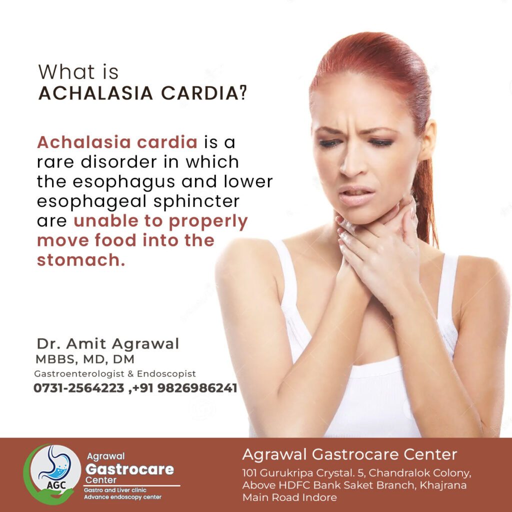 Poem for Achalasia cardia - Agrawal Gastrocare Center 