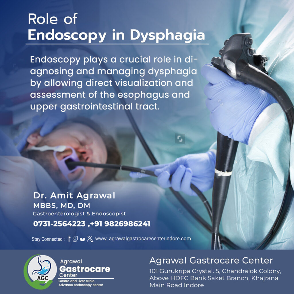Role of Endoscopy in Dysphagia