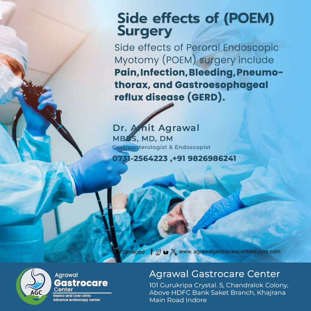 Side Effects of POEM (Peroral Endoscopic Myotomy)